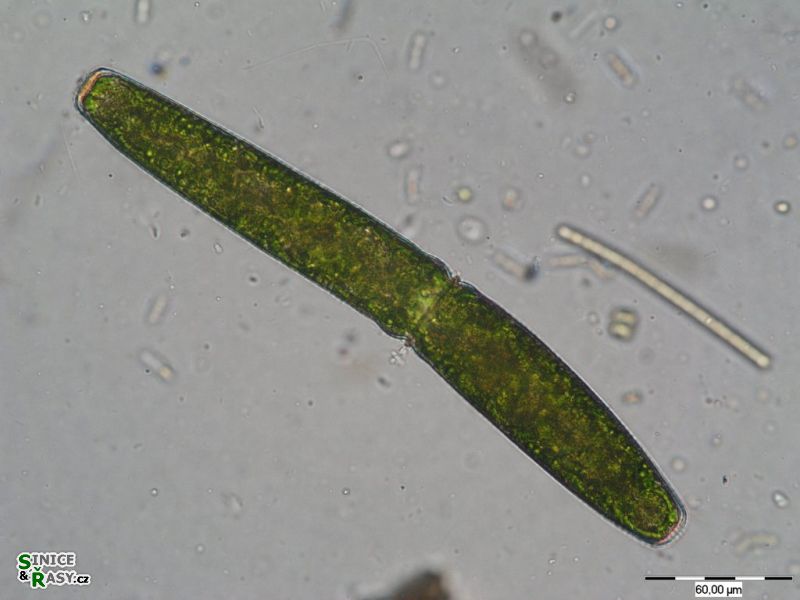 Pleurotaenium trabercula