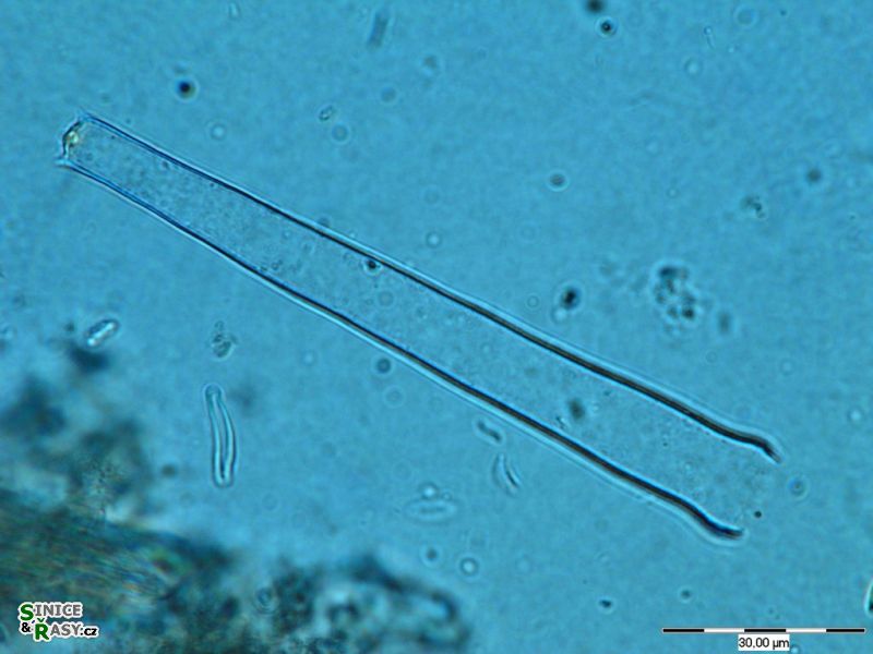 Pleurotaenium tridentulum