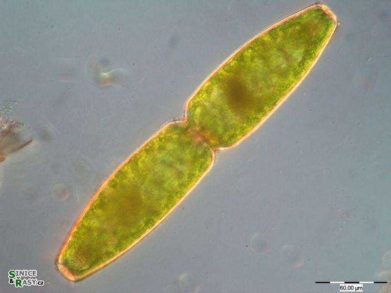 Pleurotaenium truncatum