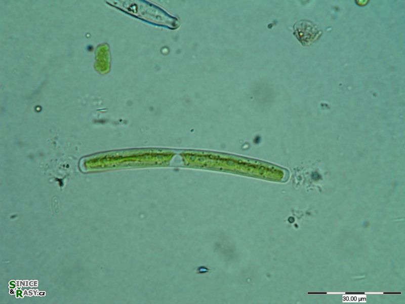 Roya anglica