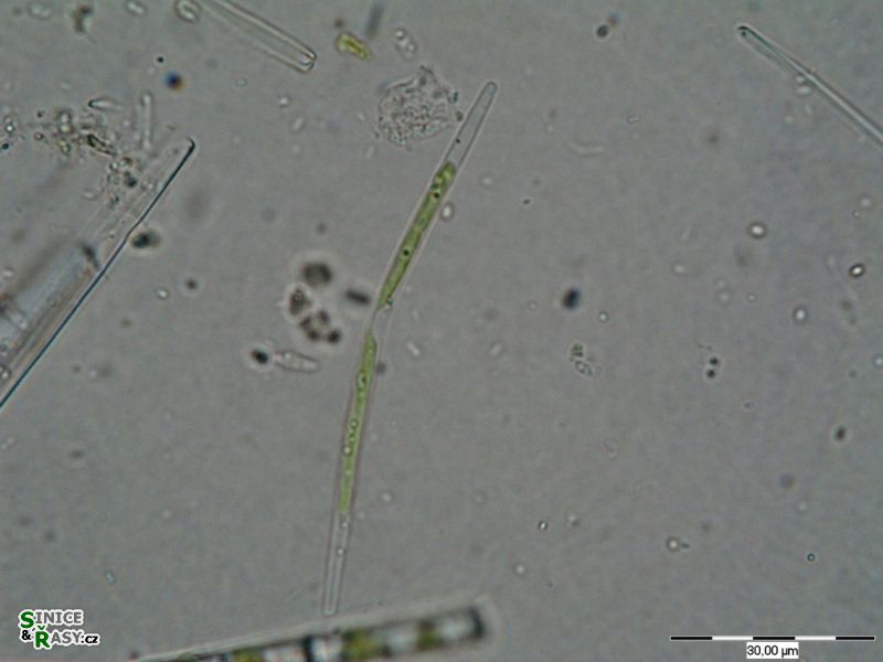 Roya pseudoclosterium
