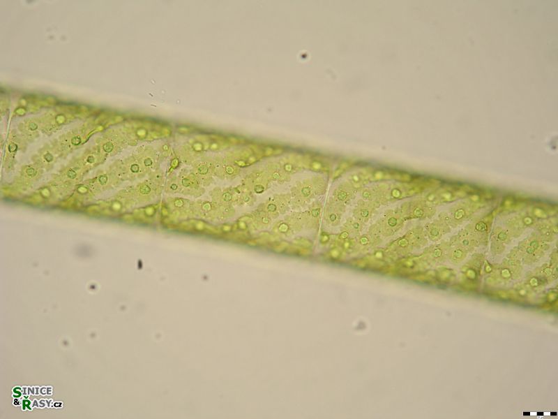 Spirogyra