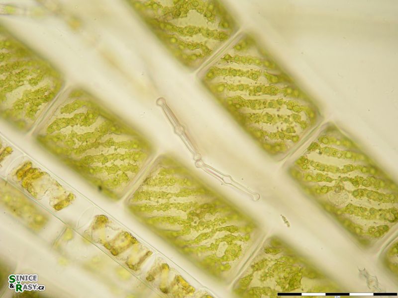 Spirogyra