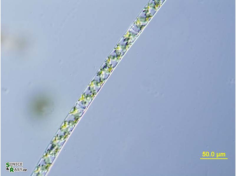 Spirogira
