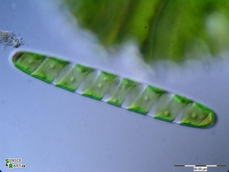 Spirotaenia condensata