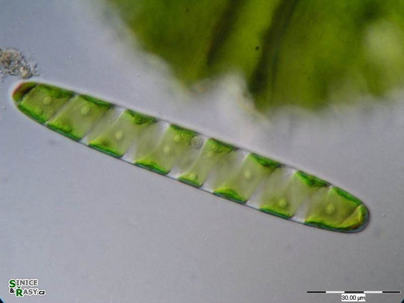 Spirotaenia condensata