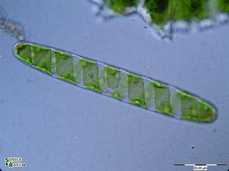 Spirotaenia condensata