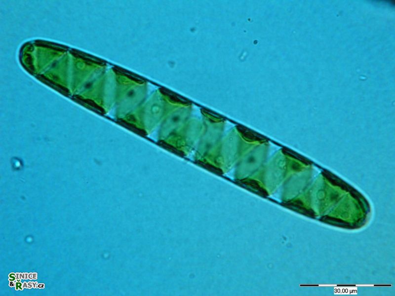 Spirotaenia condensata