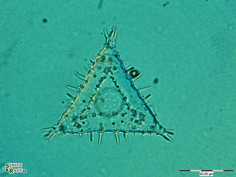 Staurastrum aculeatum