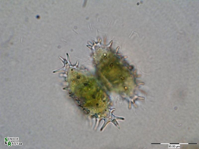 Staurastrum aculeatum