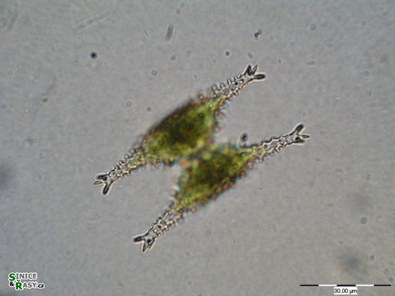 Staurastrum anatinum