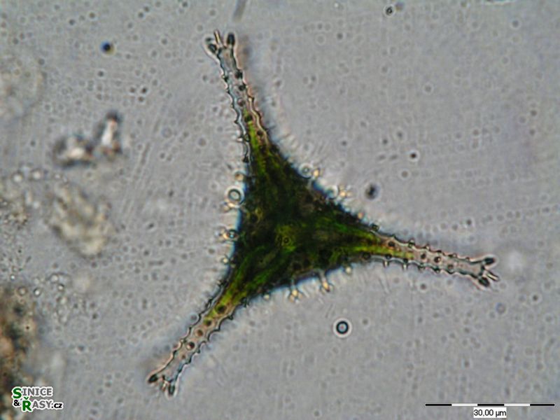Staurastrum anatinum