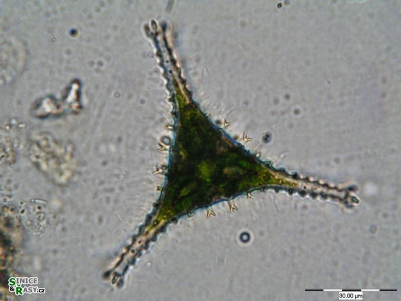 Staurastrum anatinum
