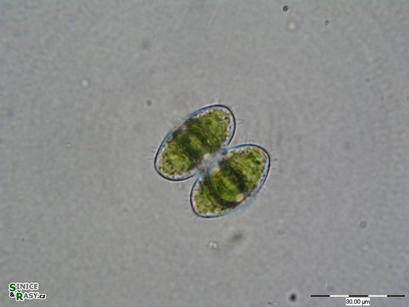 Staurastrum bieneanum