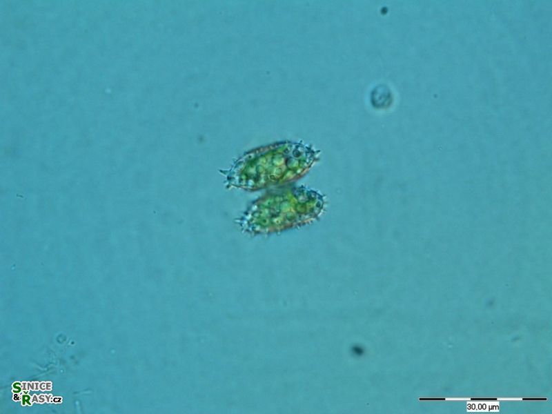 Staurastrum bohlinianum