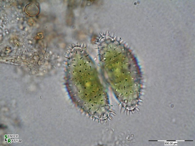 Staurastrum brebissonii
