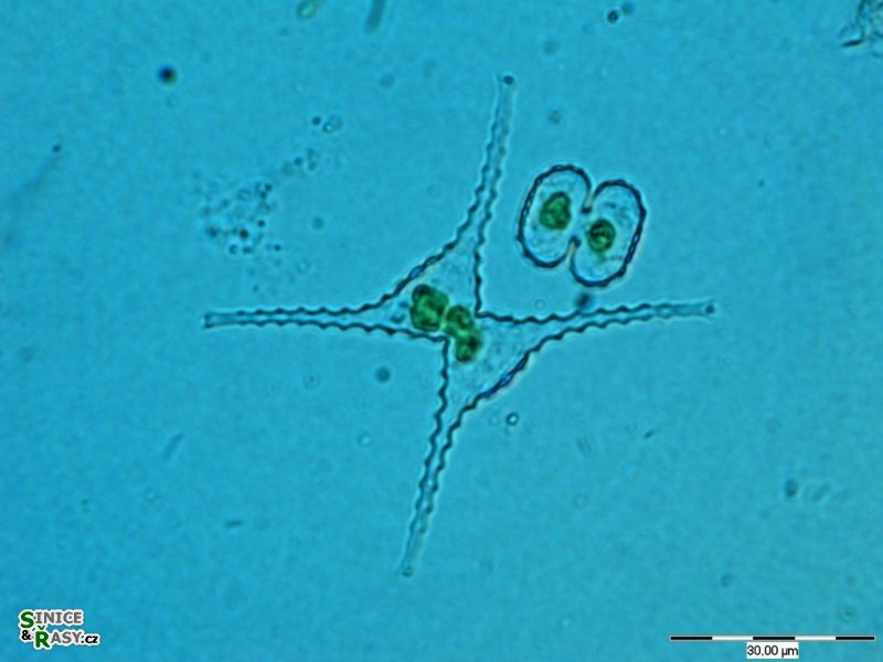 Staurastrum chaetoceras