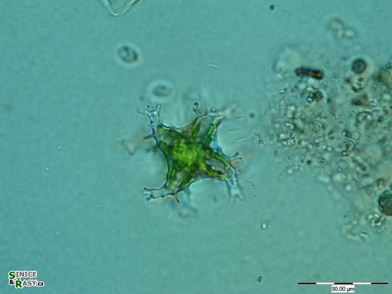 Staurastrum controversum