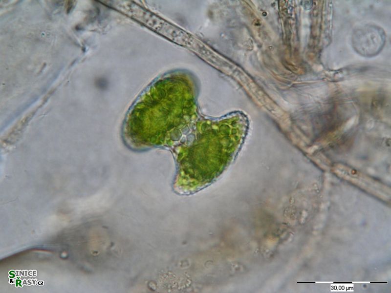 Staurastrum dilatatum
