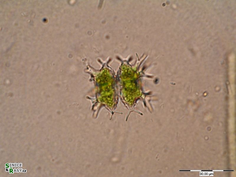 Staurastrum furcatum