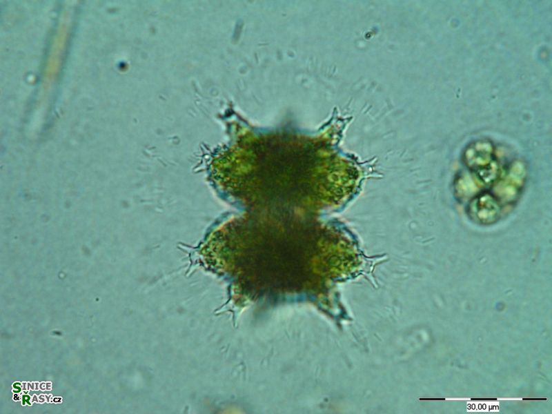 Staurastrum furcigerum