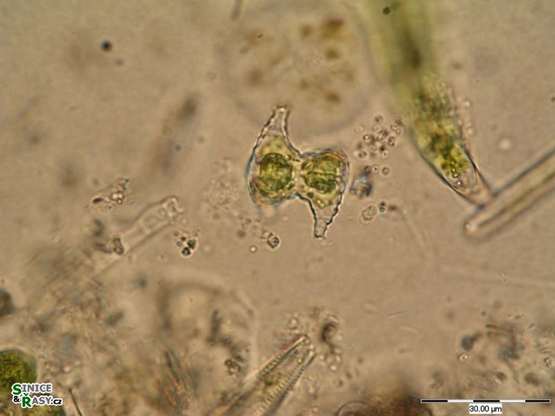 Staurastrum inflexum