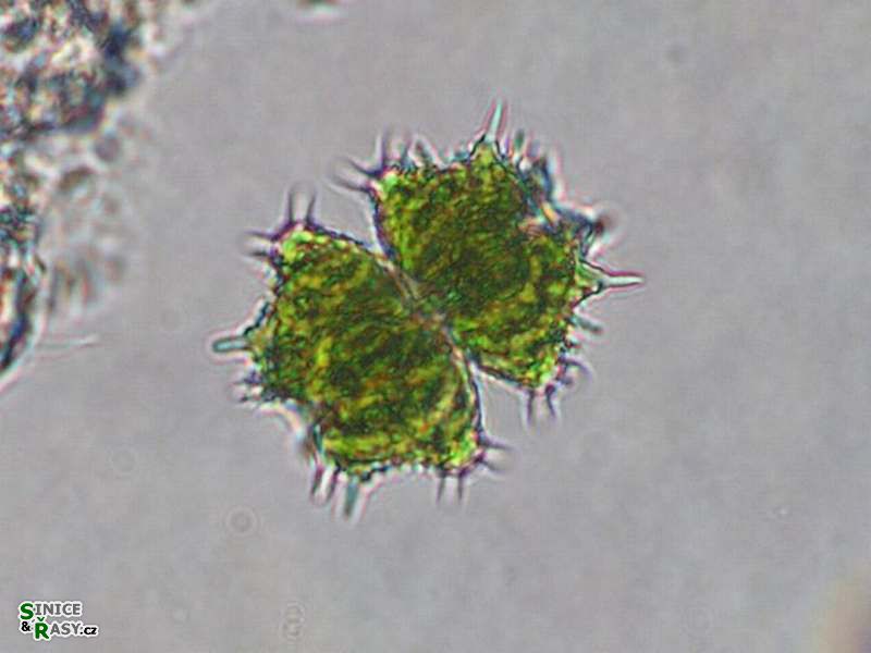 Staurastrum monticulosum