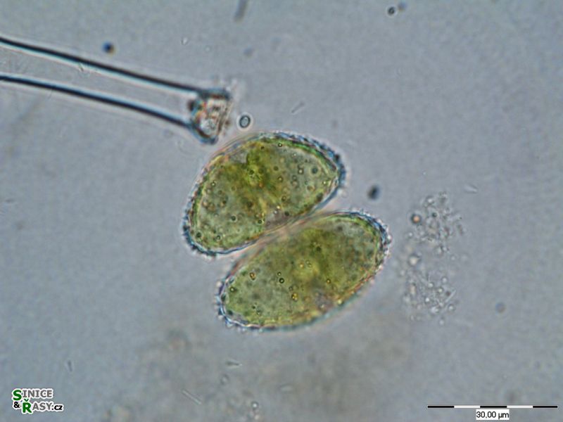 Staurastrum muricatum