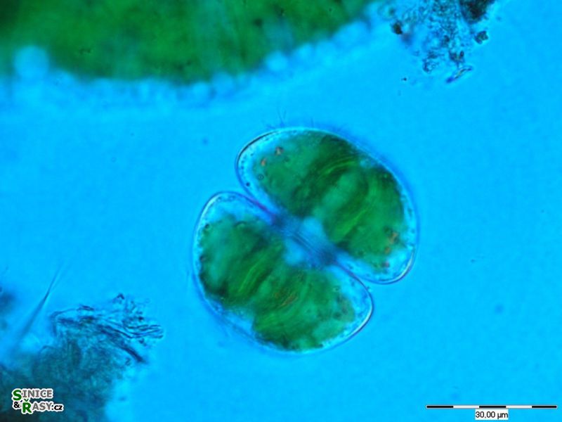 Staurastrum orbiculare