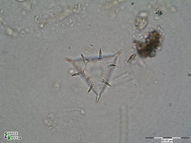Staurastrum pungens