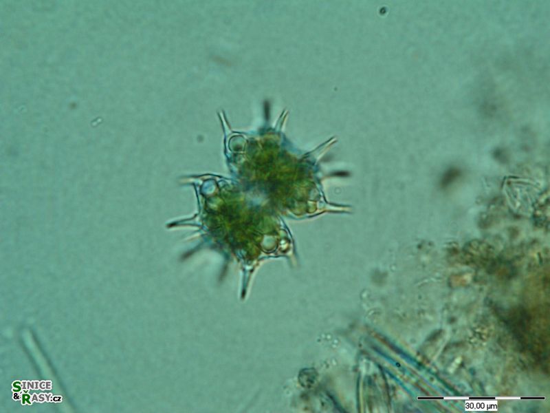Staurastrum pungens