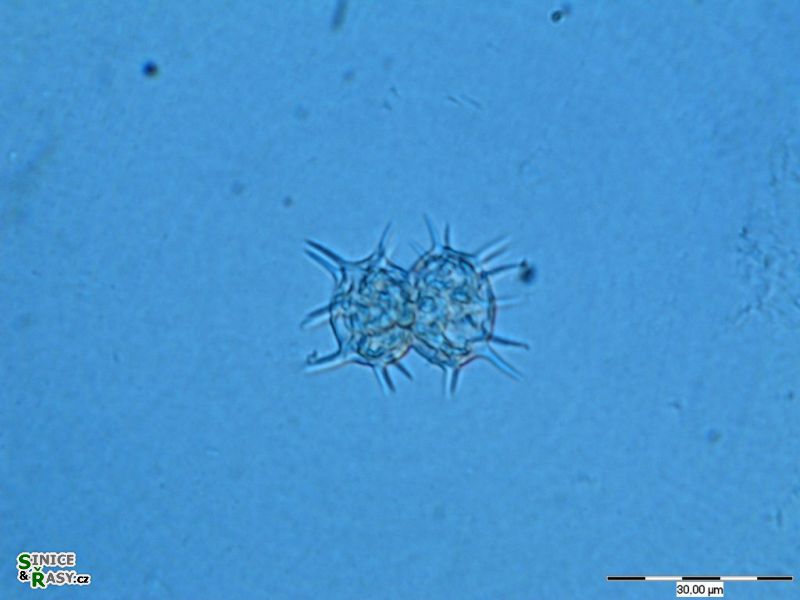 Staurastrum quadrispinatum