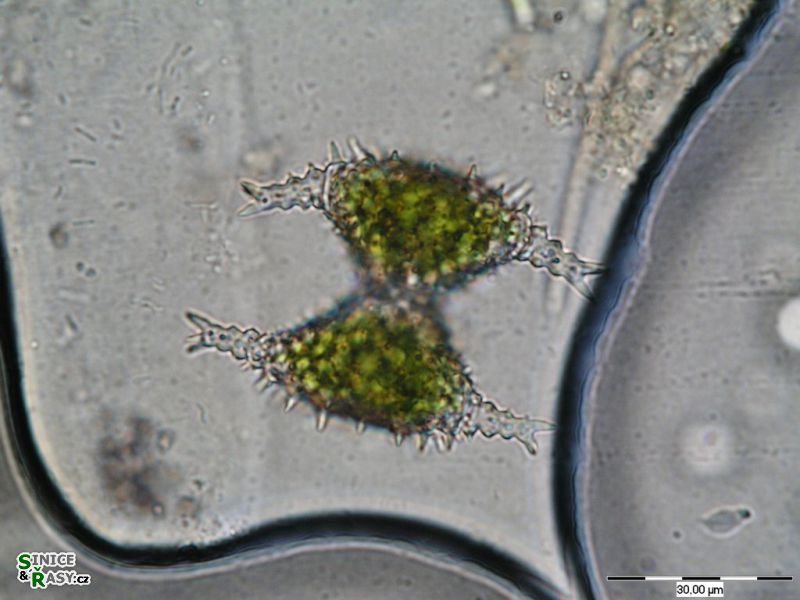 Staurastrum sebaldi