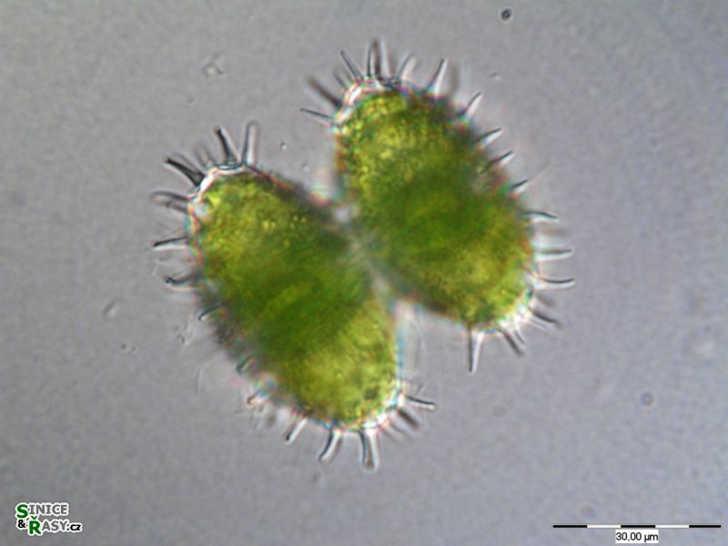 Staurastrum setigerum