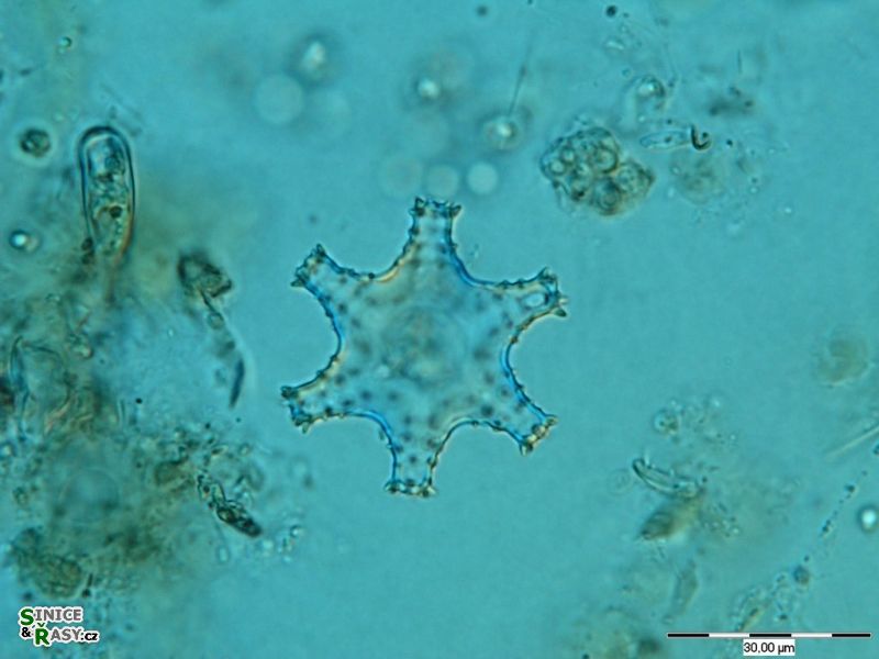Staurastrum sexcostatum