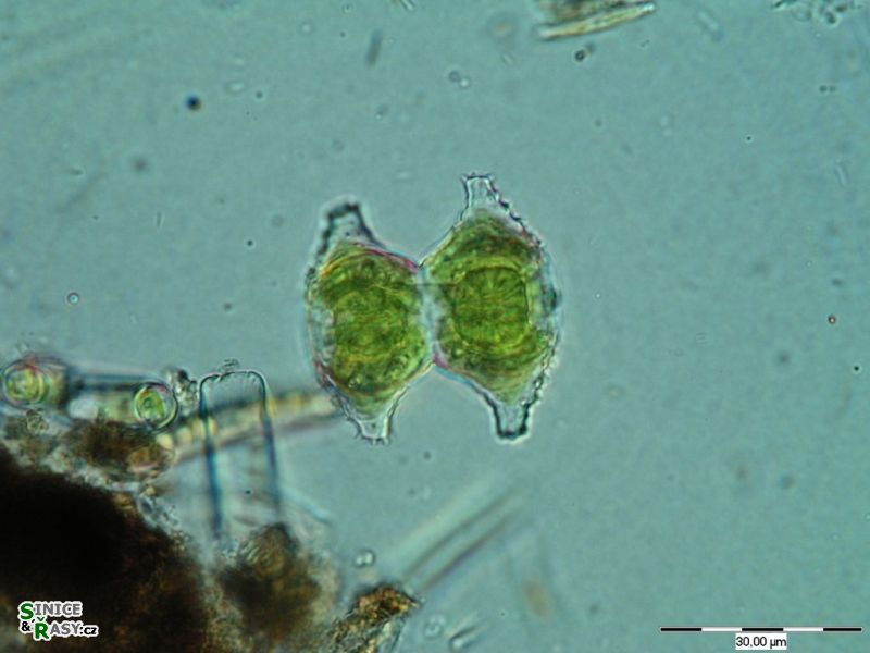 Staurastrum sexcostatum