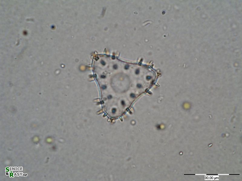 Staurastrum teliferum