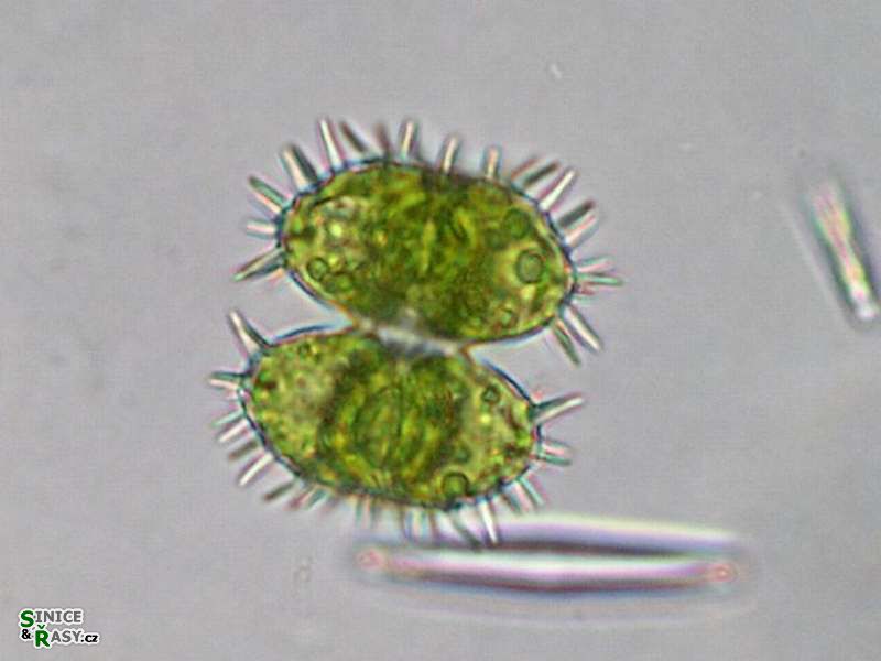 Staurastrum teliferum