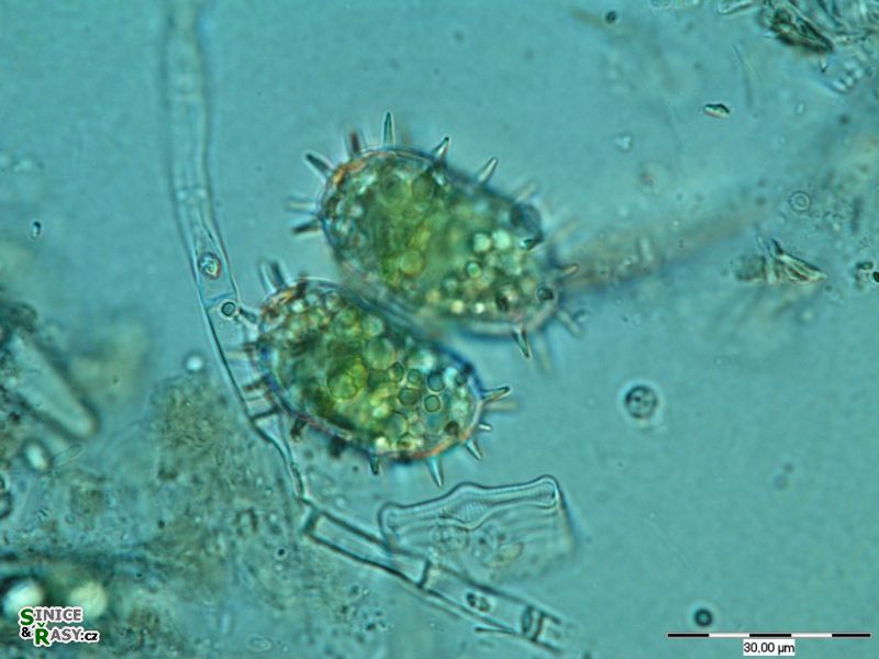 Staurastrum teliferum