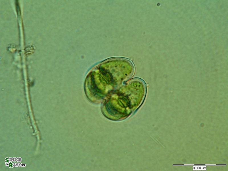 Staurodesmus brevispina