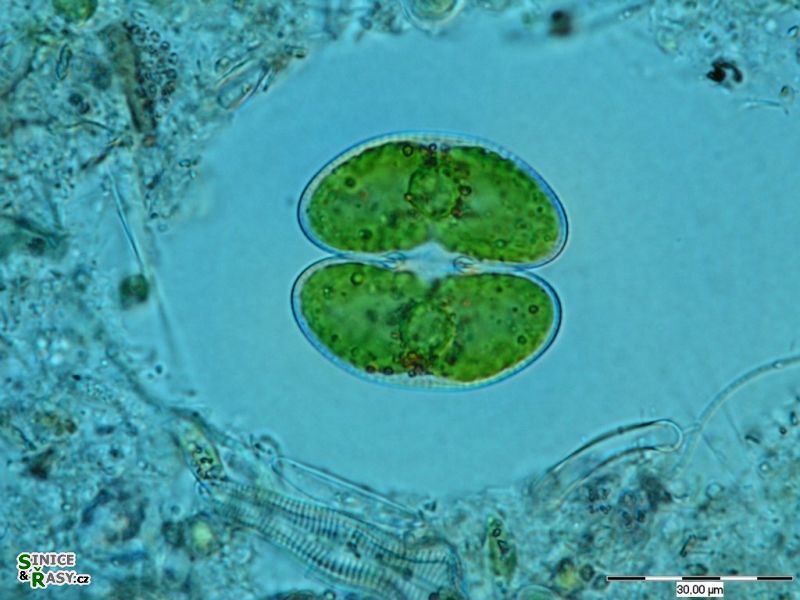 Staurodesmus convergens