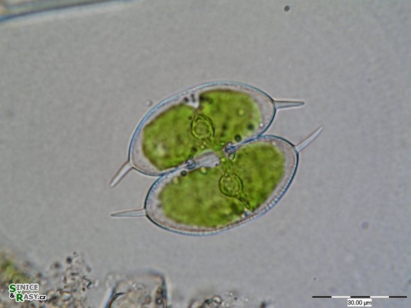 Staurodesmus convergens
