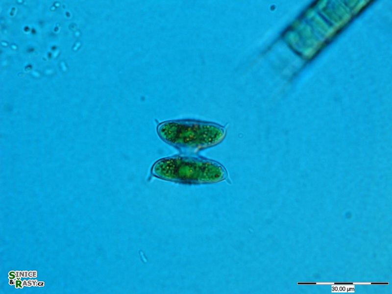 Staurodesmus dejectus