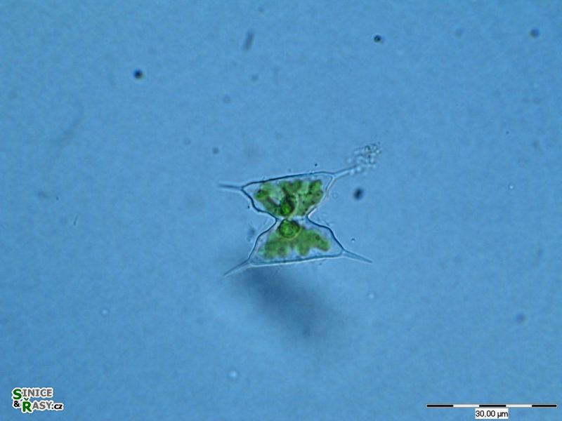 Staurodesmus extensus