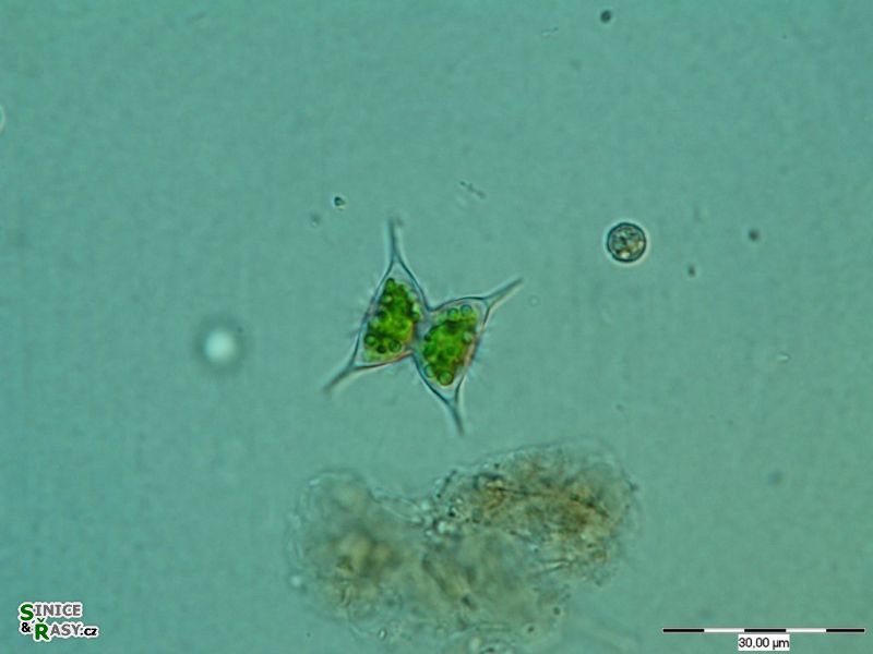 Staurodesmus omearii