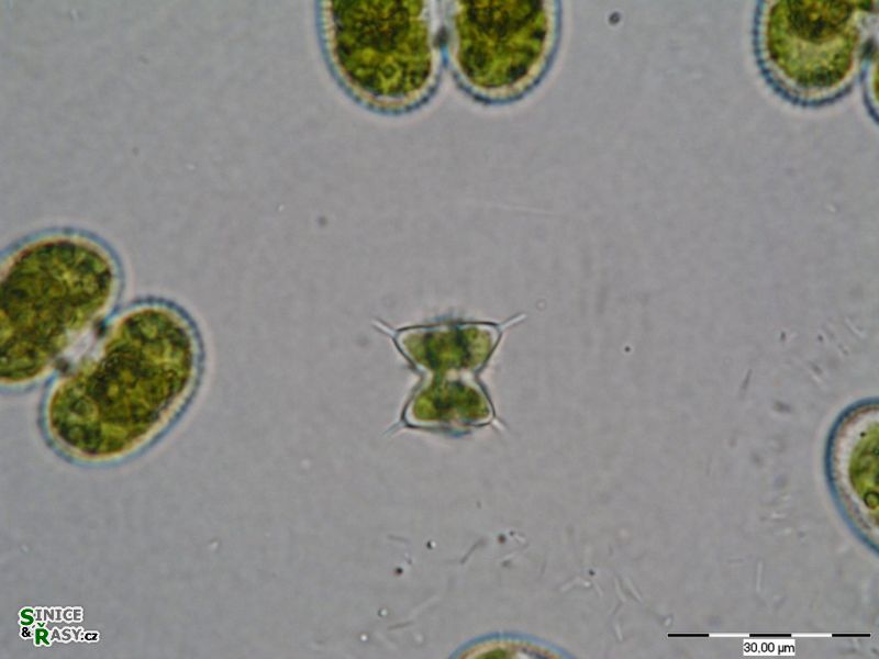 Staurodesmus pterosporus