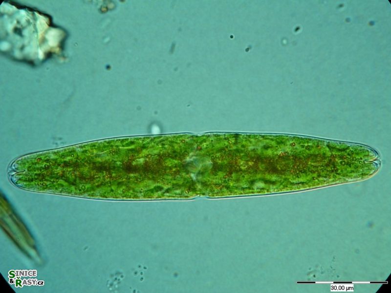 Tetmemorus granulatus