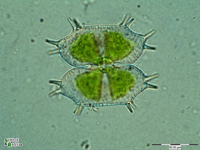 Xanthidium antilopeum