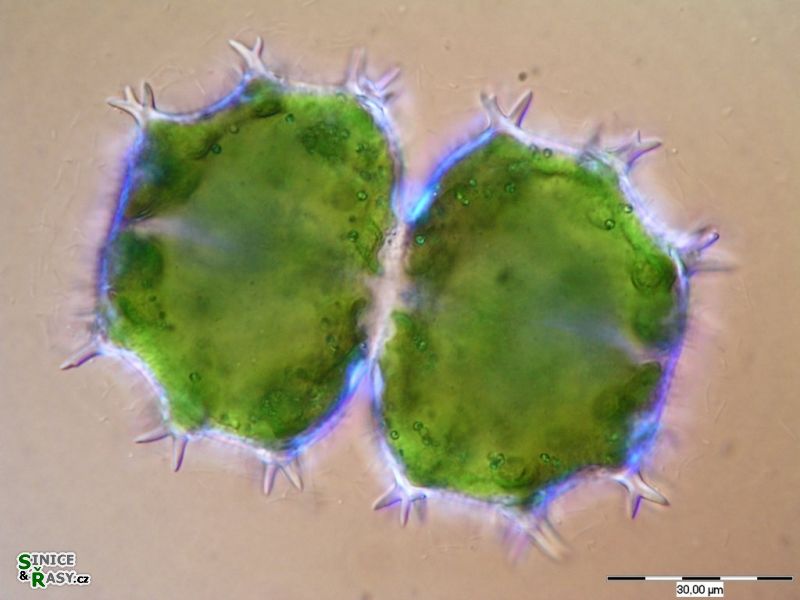 Xanthidium armatum