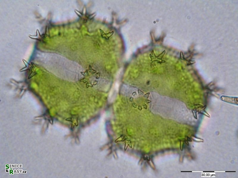 Xanthidium armatum